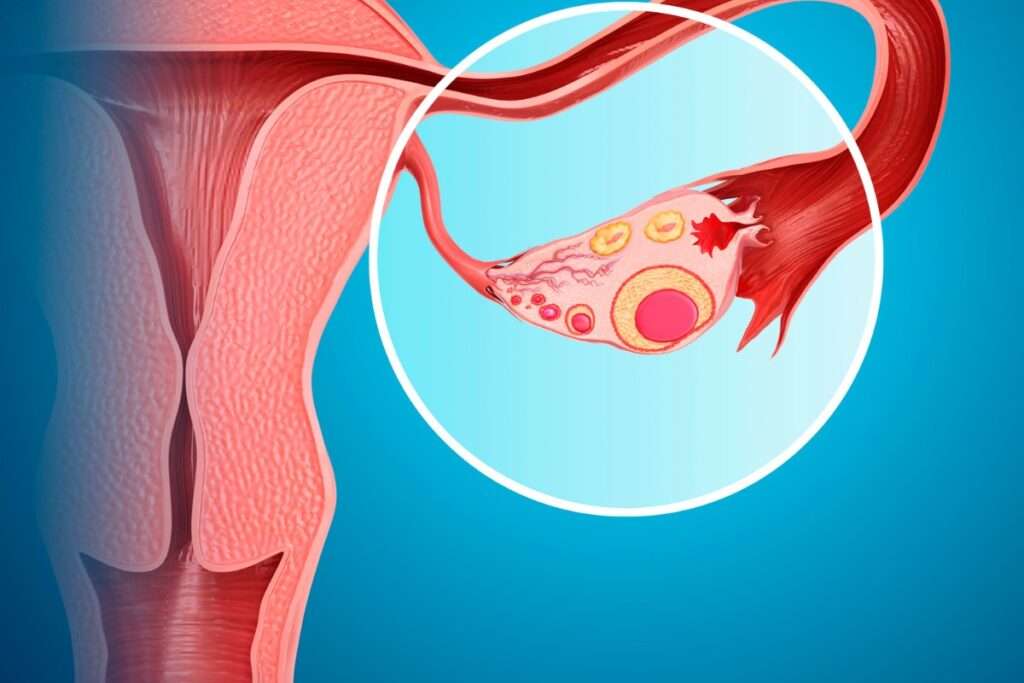 ovarian-cysts-during-pregnancy-gold-rush-hospital